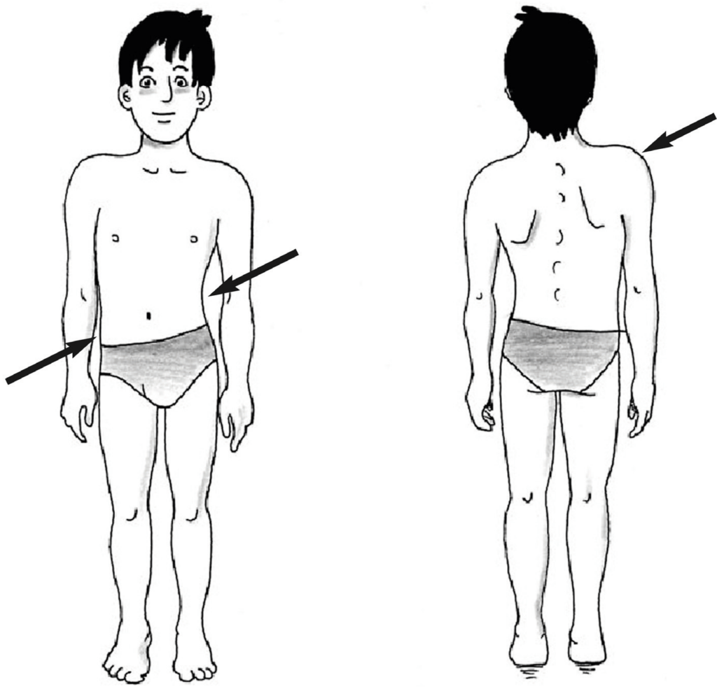 Esame schiena - Valutazione del triangolo della taglia
